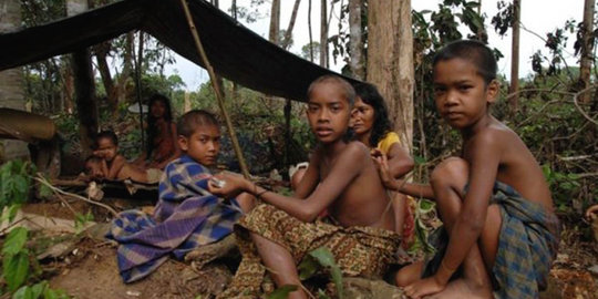 Seorang bayi Suku Anak Dalam wafat akibat radang paru-paru