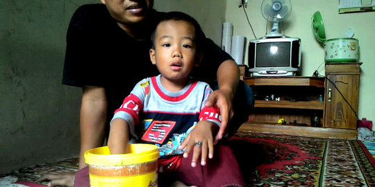 tak bisa dilepas jari tengah bocah 4 tahun bengkak rev1