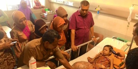 Derita Rahmatun Nisfu, anak yatim kaki bengkak terkulai lemas