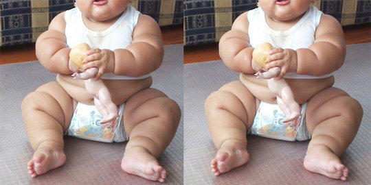 10 kasus obesitas anak paling mengejutkan di dunia