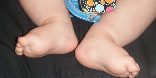 10 kasus obesitas anak paling mengejutkan di dunia