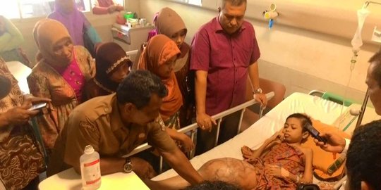 Rahmat idap tumor ganas, Gubernur Aceh datangkan dokter dari Jakarta