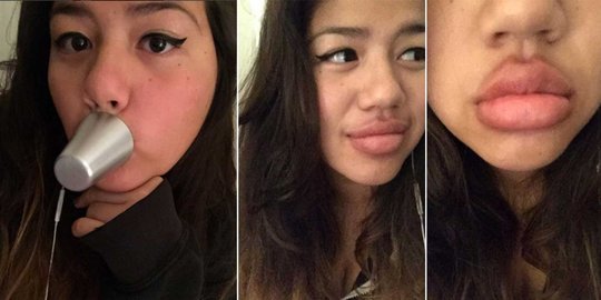 Tantangan aneh #kyliejennerchallenge yang menjadi viral di medsos