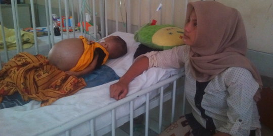 Jelang operasi, balita penderita tumor abdomen meninggal dunia