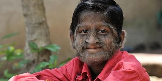 ini 5 'manusia serigala' paling terkenal di dunia!