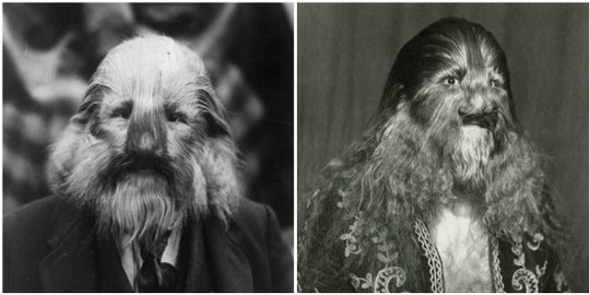 ini 5 'manusia serigala' paling terkenal di dunia!