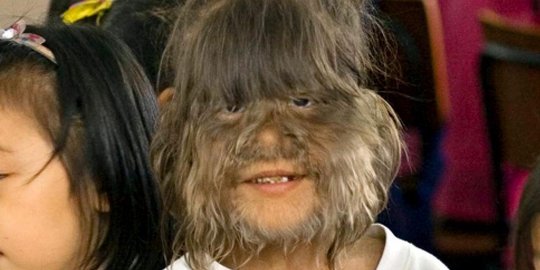 ini 5 'manusia serigala' paling terkenal di dunia!