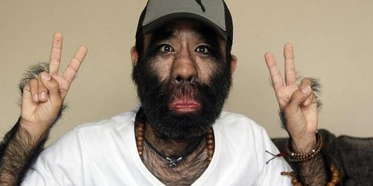 ini 5 'manusia serigala' paling terkenal di dunia!