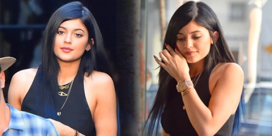 Terkuak! Bibir sensual Kylie Jenner ternyata hasil lip injection