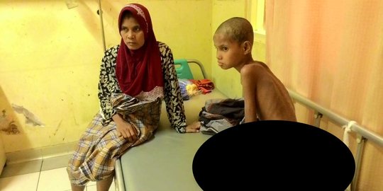 Meratapi Nasiran, bocah berperilaku aneh ditemukan di hutan Aceh