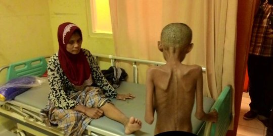 Kisah miris Nasiran & Ibunya hidup di hutan hingga berperilaku aneh