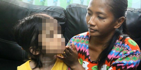 Ibu tiri di Medan siksa anak dengan minyak panas dan disabet pisau