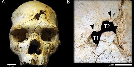 Ini tengkorak manusia pertama yang jadi korban pembunuhan di dunia