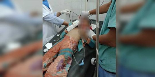 Cerita Patwal di Cirebon kabur usai tabrak bocah hingga tewas