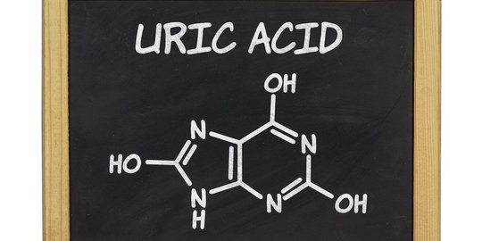 Kadar asam urat dalam tubuh berlebih? Segera lakukan 5 hal ini!