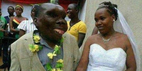 Kekuatan cinta, pria terjelek Uganda nikah dua kali punya anak 8