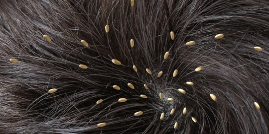 mengapa rambut manusia tak selebat gorila?