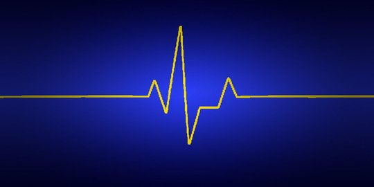Apa penyebab jantung berdenyut lambat?