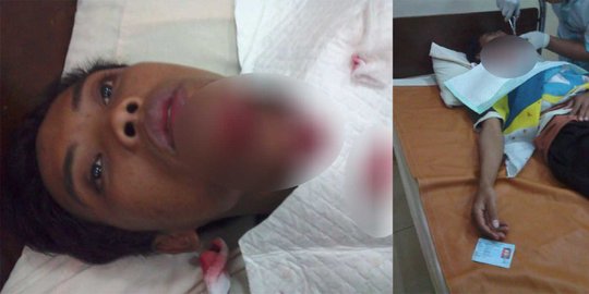 Demo tolak pabrik semen di Pati, Ari terkena peluru gas air mata