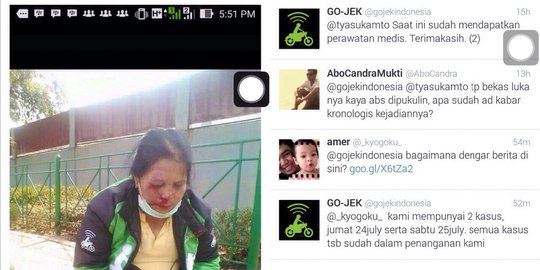 Foto wajah pengemudi wanita Gojek terluka, Gojek diserbu pertanyaan