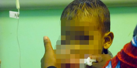 Rafa, bocah Aceh yang berjuang melawan tumor ganas