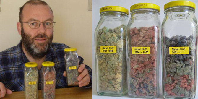 Jijik, pria ini koleksi kotoran pusarnya sendiri selama 26 