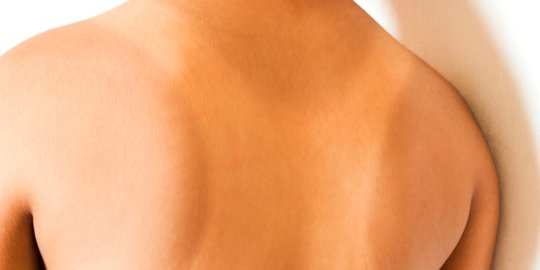 awas, 5 faktor ini bisa 'curi' kecantikan alami perempuan