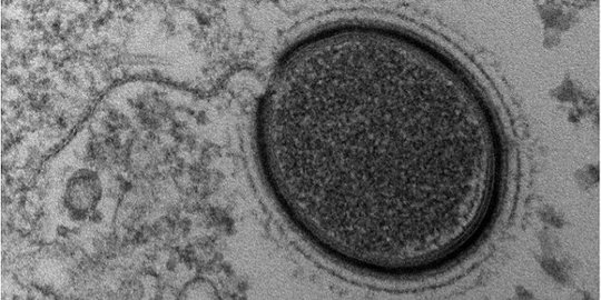 Hidupkan kembali virus raksasa kuno, ilmuwan bahayakan manusia?