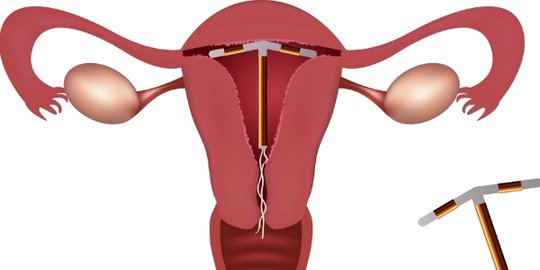 astaga, 6 hormon ini bikin wanita jadi gemuk!