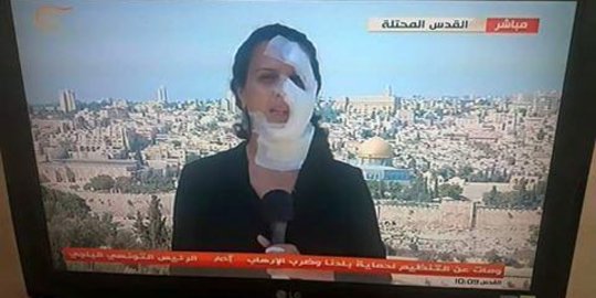 Laporkan bentrok Yerusalem Timur, jurnalis wanita digranat Israel