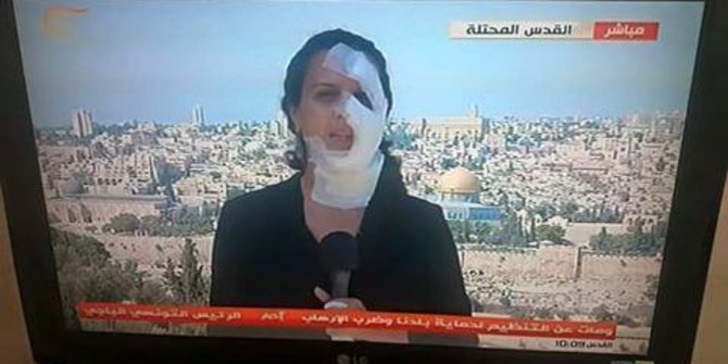 Laporkan bentrok Yerusalem Timur, jurnalis wanita digranat Israel