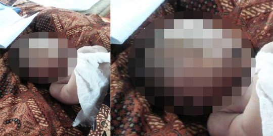 Kakak bayi Husen Saputra juga terserang ISPA