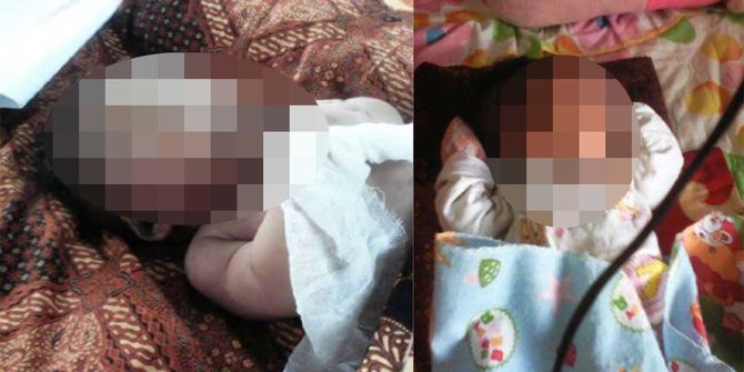 Derita bayi Husen meninggal akibat paru-paru lembap terkena asap
