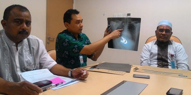 Peluru di dada Uyung korban kerusuhan Singkil berhasil diangkat