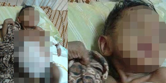 Fathan menderita tumor ganas dan kini terbaring lemas di rumah sakit