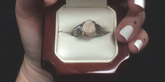 Pria ini melamar kekasihnya dengan cincin bertahta gigi