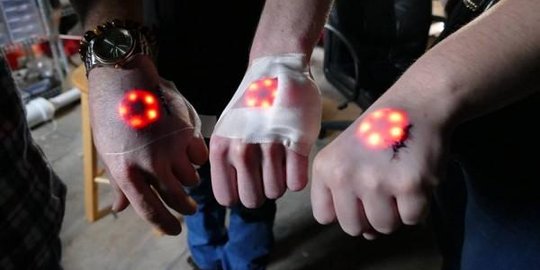 Keren dengan menanam LED di bawah kulit, berani coba?