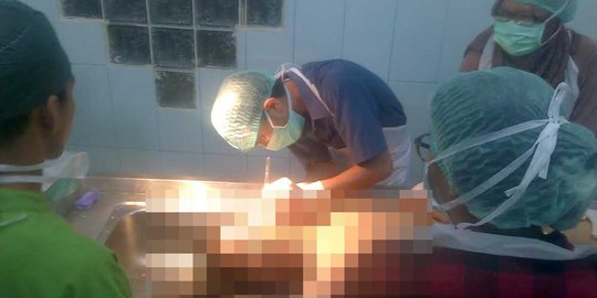 Pengantin baru tewas mengenaskan, banyak luka lebam di tubuh