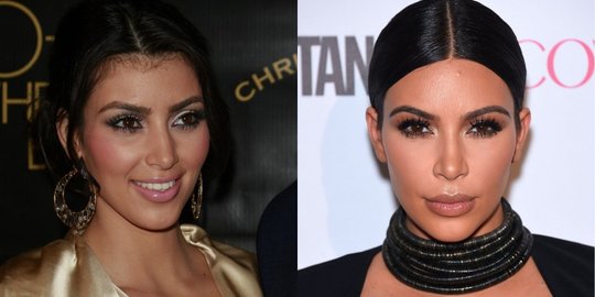 5 Seleb yang ternyata lebih cantik sebelum jalani oplas