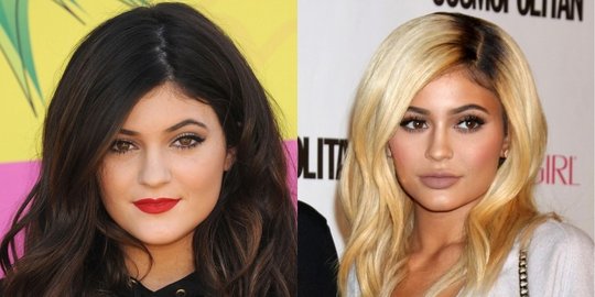 5 seleb yang ternyata lebih cantik sebelum jalani oplas