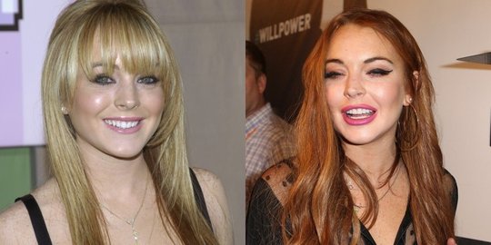 5 seleb yang ternyata lebih cantik sebelum jalani oplas