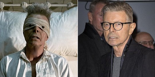 Ini kanker hati yang renggut nyawa David Bowie