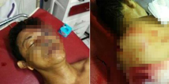 2 Polisi dibacok & 1 hilang saat gerebek narkoba, ini kronologinya
