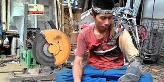 Kisah inspiratif Tawan si 'Iron Man' pemilik tangan bionik