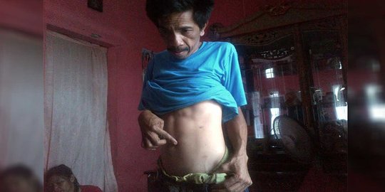Banyak warga Majalaya rela jual ginjal demi menyambung hidup