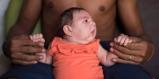 Lima hal penting tentang zika, virus berbahaya bagi ibu hamil