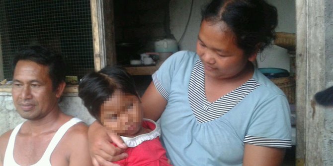 Putri pertama hydrocephalus, Pasutri ini takut punya anak lagi