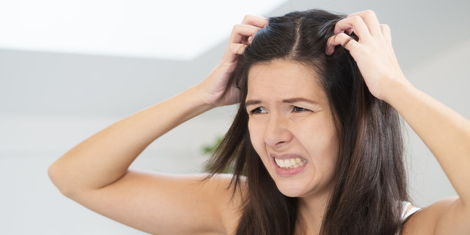 Rambut sering gatal? Bisa jadi itu eksim rambut