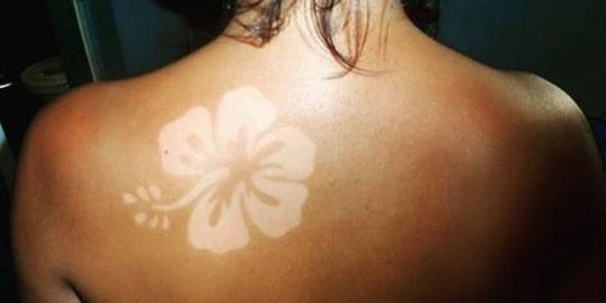 sunburn art