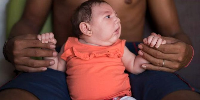 Lebih dari 5 ribu wanita hamil di Kolombia positif tertular Zika